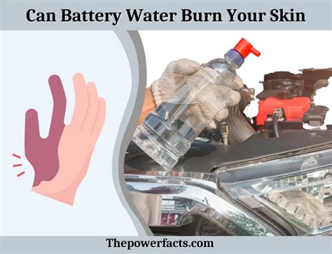 how to wash battery acid off skin|What To Do When Battery Acid Hits Skin: Effective Steps